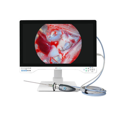 Купить 32-inch 4K Medical Endoscope Camera with 8-Hour Battery Life онлайн изготовление