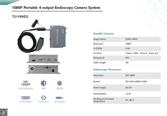 Купить TUYOU TU-Y4HDS 1080P Portable Medical Endoscope Camera with HDMI/CVBS онлайн изготовление