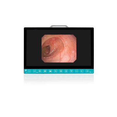 Купить TUYOU 13.3-Inch FHD Flexible Endoscope Camera System Multi-Color OEM Custom All-in-One Portable Uro-Gyn TikTok Hit онлайн изготовление