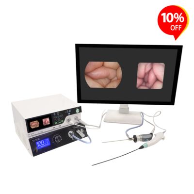 Купить TUYOU HD Endoscopy Camera System with ENT Bronchoscopy Checking and Laparoscopy Urology Applications Featuring Auto White Balance онлайн изготовление
