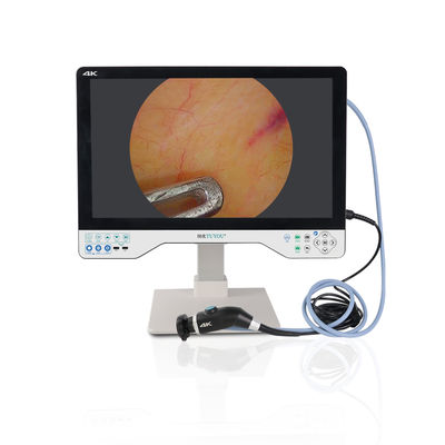 Купить Manufacturer Direct 24 Inches 1080P All-in-one Camera System For Laparoscopy Surgery ENT Checking онлайн изготовление