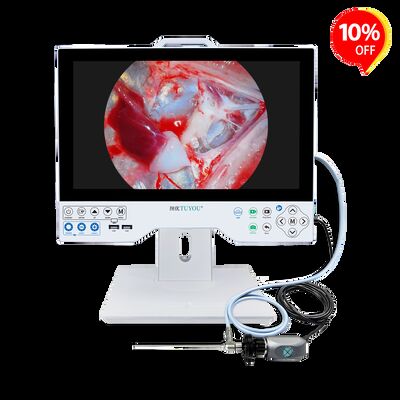 Купить Economical Full HD All-in-One Endoscope Camera System - CE Certified Integrated Monitor for Laparoscopy/Gynecology Exams онлайн изготовление