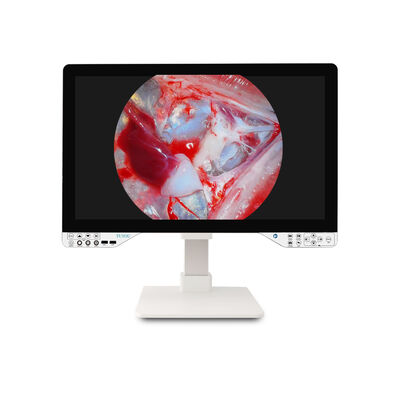 Купить Medical Grade TUYOU 27 Inch All-in-One Endoscopic Camera - FHD/4K for ENT Laparoscopic Procedures онлайн изготовление