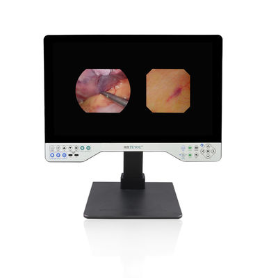 1080P Full HD Endoscope System Жесткая и гибкая 24-дюймовая видеокамера
