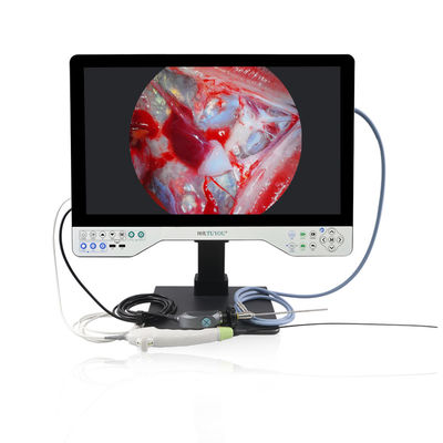 15-дюймовая камера для выбора режима монитора TUYOU All-in-One Medical Endoscope Camera с источником света для урологии и гинекологии