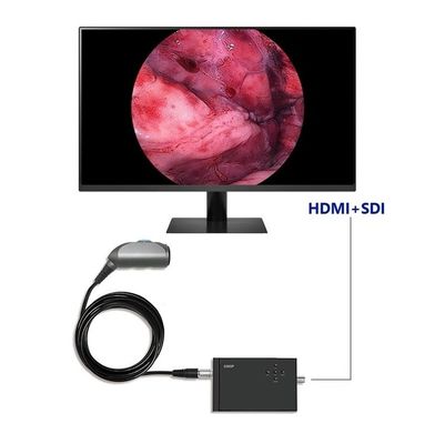 TUYOU портативная видеокамера для эндоскопии Full HD 1920x1080 разрешение 120 градусов Поле зрения для урологии позвоночника и ЛОР хирургии