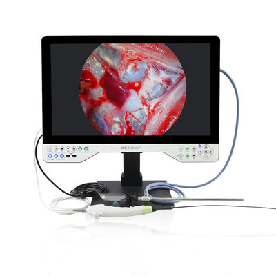 4K All In One Endoscope Camera System Встроенный светодиодный свет и гибкая область для лапароскопии