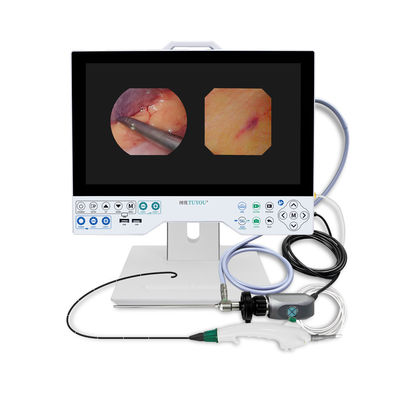 TUYOU Brain Surgery Tool All-in-One Жесткая и гибкая система эндоскопической камеры для обследования матки