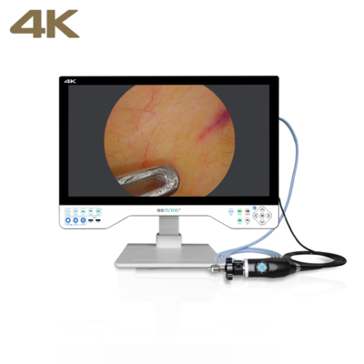 Универсальная эндоскопическая камера TUYOU All-in-One FHD с 24-дюймовым хирургическим монитором для урологических процедур