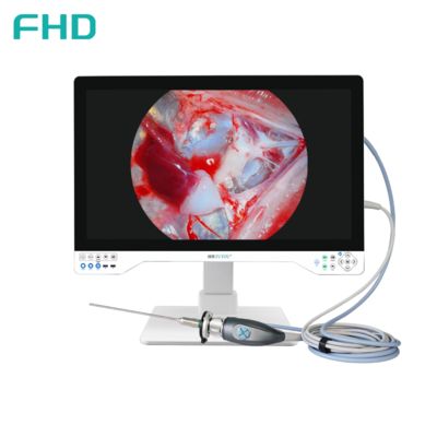 TUYOU All-in-One FHD Endoscopy Camera System с 32-дюймовым хирургическим монитором для ЛОР и урологических процедур