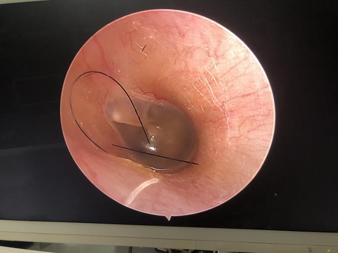 Портативный ЖК-монитор Все в одном HD Эндоскопическая камера для ЛОР лапароскопии гистероскопии урологии 2