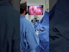 Система камер TU-LSD90TB 2 в 1 с холодным источником света для лапароскопии и ЛОР