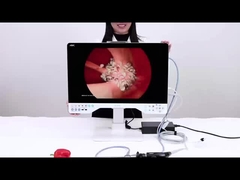 24дюймовый TUYOU Назофарингоскоп Эндоскоп Камера для высококачественной лапароскопии