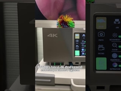 Система камер 4K с увеличением кровеносных сосудов